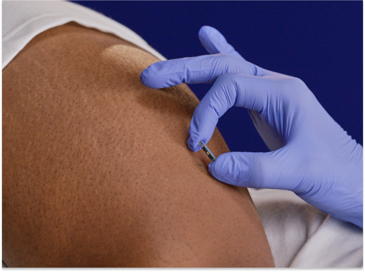 this is 50 | 50 image